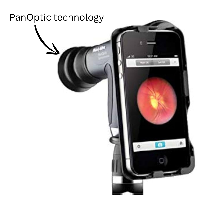 PanOptic Ophthalmoscope